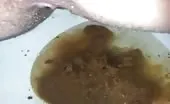 Shitting a lot over toilet