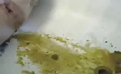 Diarrhea with pressure