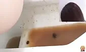 She has serious diarrhea